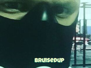 Bruisedup